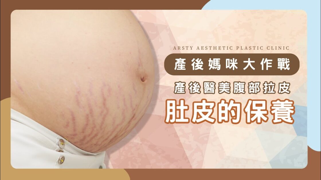 產後肚皮保養－陳心瑜醫師告訴妳對付鬆弛和妊娠紋的黃金時機